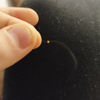 Kandiz Aldığım Cips Paketinden Saç Teli Çıktı, Hijyen Sorunu Yaşadım