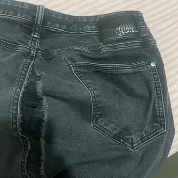 Mavi Pantolonumda Deformasyon Ve Çözümde Mağduriyet Yaşadım