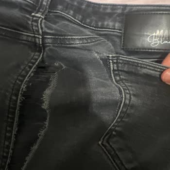 Mavi Pantolonumda Deformasyon Ve Çözümde Mağduriyet Yaşadım