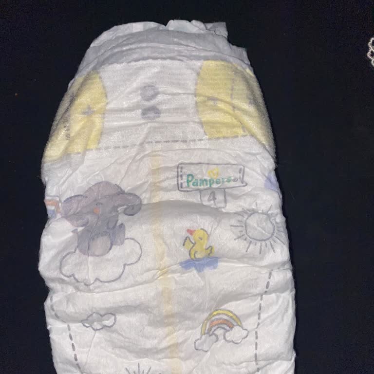 Prima Bebek Bezlerinde Ani Kalite Düşüşü Ve Pişik Sorunu Yaşadık