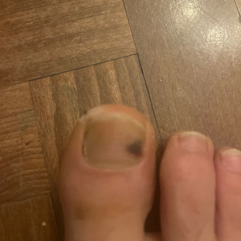 Aldığım Bot Ayağımı Yaraladı, Sorunum Çözülmedi