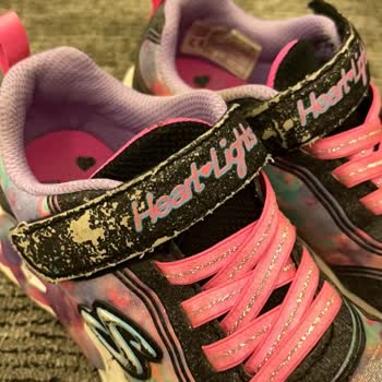 Kısa Sürede Deforme Olan Skechers Ayakkabıya Gerekçesiz Ret Kararı Mağduriyetim Giderilsin