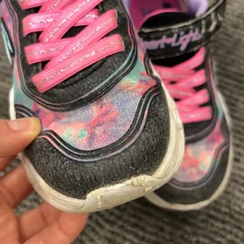 Kısa Sürede Deforme Olan Skechers Ayakkabıya Gerekçesiz Ret Kararı Mağduriyetim Giderilsin