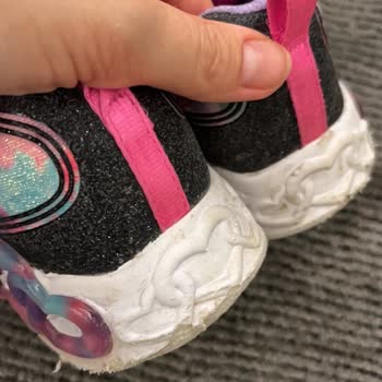 Kısa Sürede Deforme Olan Skechers Ayakkabıya Gerekçesiz Ret Kararı Mağduriyetim Giderilsin