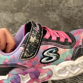 Kısa Sürede Deforme Olan Skechers Ayakkabıya Gerekçesiz Ret Kararı Mağduriyetim Giderilsin