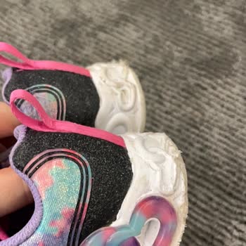 Skechers Kısa Sürede Deforme Olan Ayakkabı Ve Gerekçesiz Ret Sonucu Mağduriyet