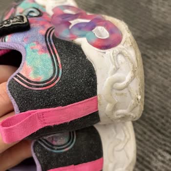 Skechers Kısa Sürede Deforme Olan Ayakkabı Ve Gerekçesiz Ret Sonucu Mağduriyet