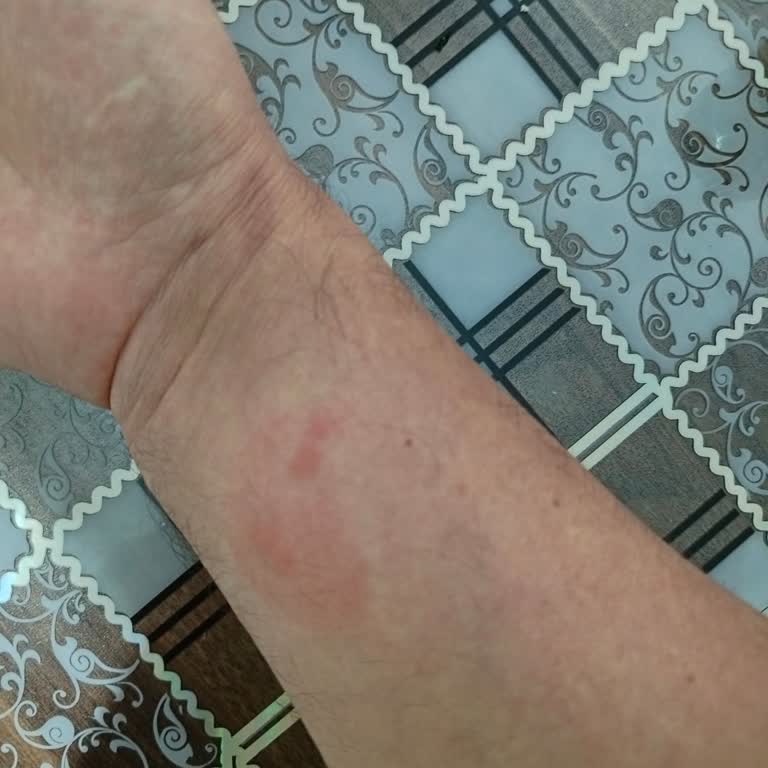 Kamil Koç Otobüsünde Ciddi Hijyen Sorunu Ve Sağlık Riski