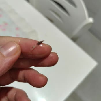 Derya Ton Balığı Konservesinden Yabancı Madde Çıkması Ve Hijyen Endişesi!