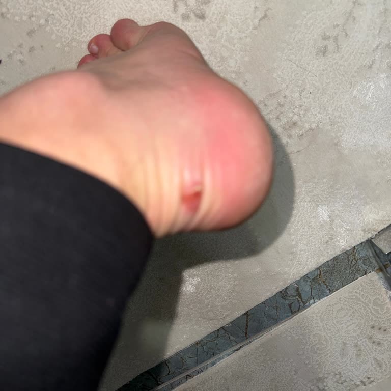 Kalıbı Hatalı Ayakkabı İçin Değişim Reddi Ve Müşteri Mağduriyeti