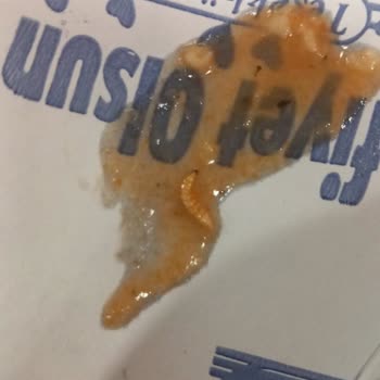 KYK Yurdunda Yemeklerde Tekrar Eden Hijyen Sorunu Ve Kurt Çıkması Endişesi