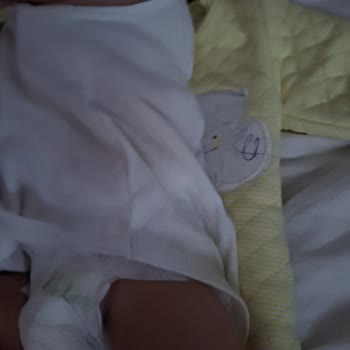 Sleepy Bebek Bezinde Ani Sızıntı Sorunu Kıyafetler Mahvoldu