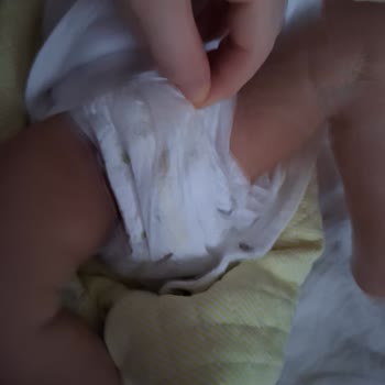 Sleepy Bebek Bezinde Ani Sızıntı Sorunu Kıyafetler Mahvoldu