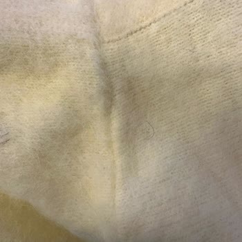 Kirli Ürün Ve Yanıltıcı İade Süresi Mağduriyeti Yaşadım