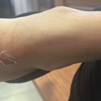 Aynı Numara Ayakkabıda Kalıp Farkı Ve İade Reddi Mağduriyeti