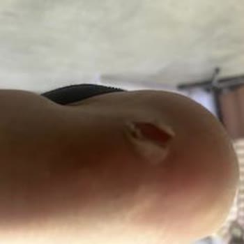 Aynı Numara Ayakkabıda Kalıp Farkı Ve İade Reddi Mağduriyeti