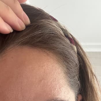 L’Oreal Paris Saç Boyası Beyazları Kapatmadı, Hayal Kırıklığı Yaşadım