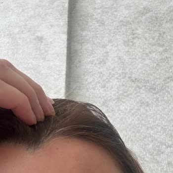 L’Oreal Paris Saç Boyası Beyazları Kapatmadı, Hayal Kırıklığı Yaşadım