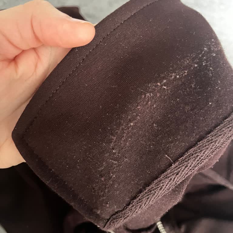 İki Kez Giyilen Sweatshirtte Bitlenme Ve Hijyen Sorunu