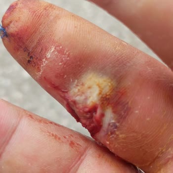 Ameliyatı Yapan Doktorun Kimliği Ve İhmaller Açıklanmadı