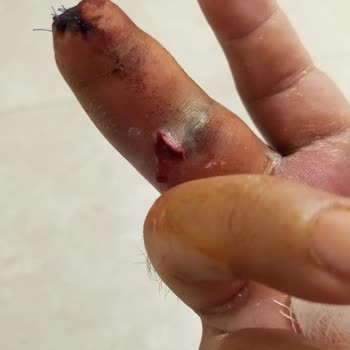 Ameliyatı Yapan Doktorun Kimliği Ve İhmaller Açıklanmadı