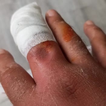 Ameliyatı Yapan Doktorun Kimliği Ve İhmaller Açıklanmadı