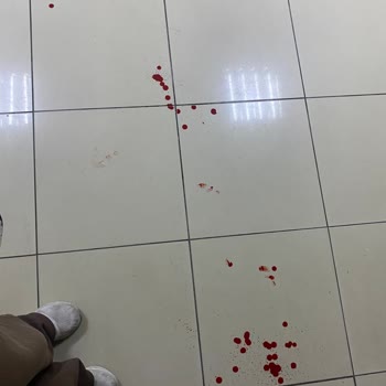 Yoğun Bakımda Yetersiz Bakım Ve Hemşire İhmali Annemin Sağlığını Tehlikeye Attı