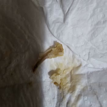 Hazır Tavuk Ürününde Büyük Kemik Tehlikesiyle Karşılaştım