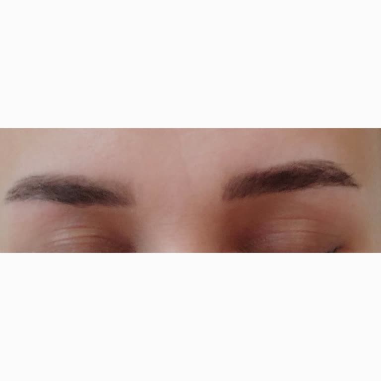 Zeynep Betül İnceler Beauty Mağduriyeti