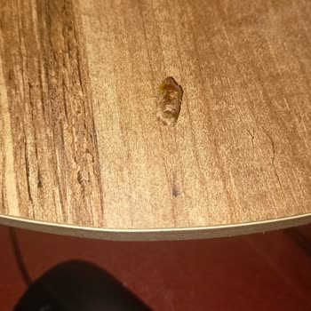 Granola İçinden Çıkan Çekirdek Dişime Zarar Verdi, Güvenlik Endişesi Yaşadım