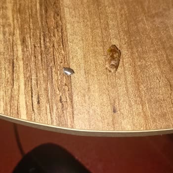 Granola İçinden Çıkan Çekirdek Dişime Zarar Verdi, Güvenlik Endişesi Yaşadım