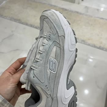 Yıkama Sonrası Skechers Ayakkabıda Anormal Renk Değişimi Ve Mağduriyet