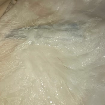 Satın Aldığım Yoğurttan Çıkan Yabancı Maddeler Nedeniyle Sağlık Endişesi