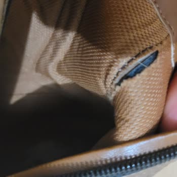 FLO'dan Aldığım Bot Ayağımı Yaraladı, Kısa Sürede Deforme Oldu!