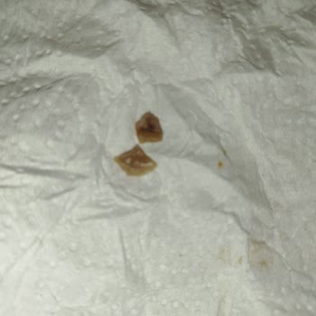 Eti Hoşbeş Gofretin İçinden Şüpheli Parçalar Çıktı