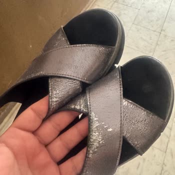 Derimod Sandaletlerde Erken Bozulma Ve Cilt Sorunları Sonrası Yetersiz Müşteri Hizmeti