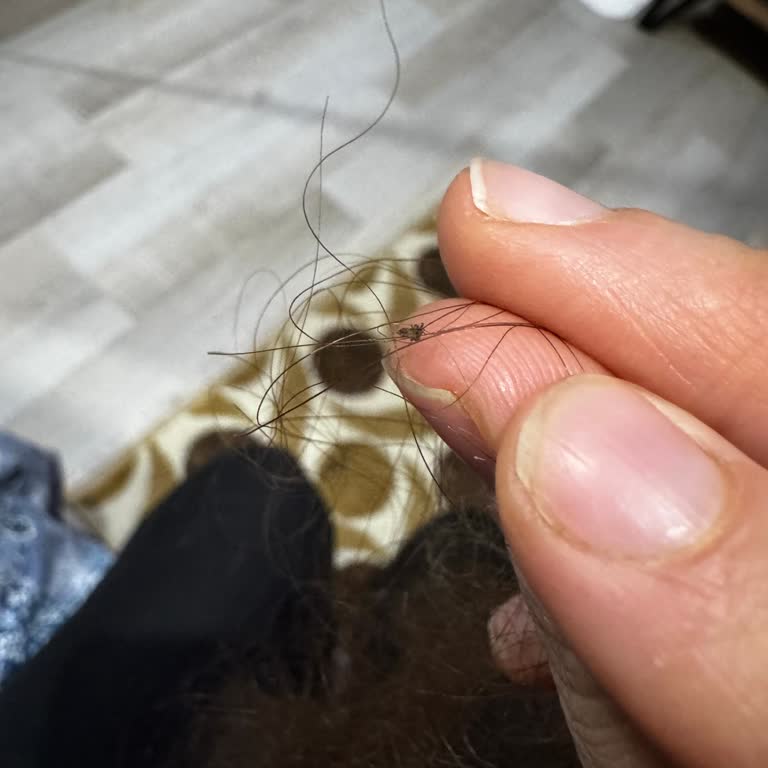 Uni Baby Saç Açıcı Sprey Sonrası Tüm Ailede Bitlenme Ve Mağduriyet