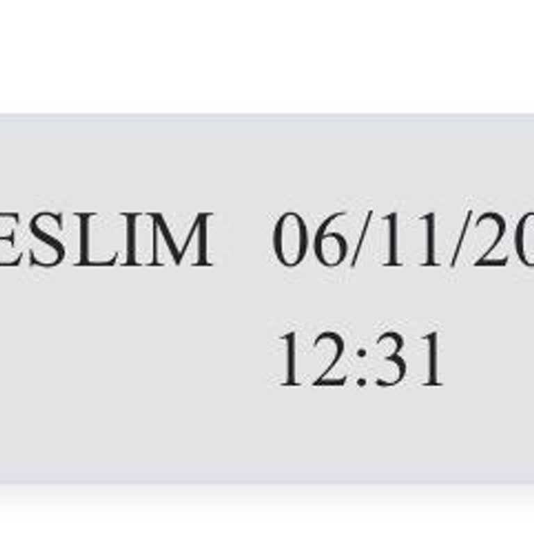 Ziraat Bankası Kartımın Teslimatı 1 Aydır Gerçekleşmedi