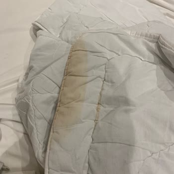 Mahya Hotel Hijyen Sorunu