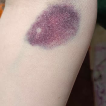 Kan Alma İşleminde Dikkatsizlik Ve Saygısız Davranış