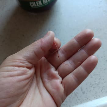 Çilek Reçelinden Çıkan Yabancı Cisim Sağlığımı Tehdit Etti