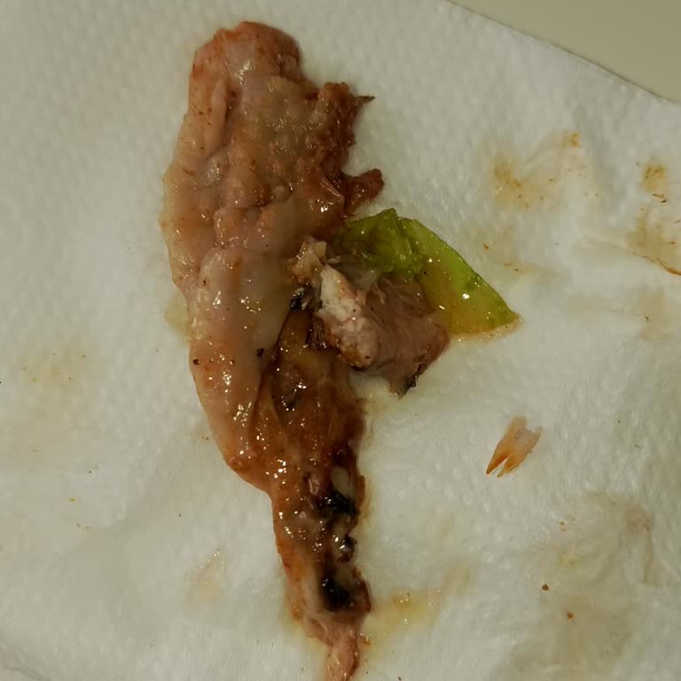 Siparişimde Çiğ Et Çıkması Nedeniyle Sağlığım Tehlikeye Girdi