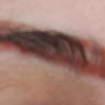 Bahar Acar Güzellik Merkezi Mikroblading Sonrası Kaşlarımda Kızarıklık Ve Sağlık Sorunları Yaşıyorum