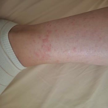 Zeyno Züccaciye Ve Tuhafiye | Gaziantep Mağduriyeti