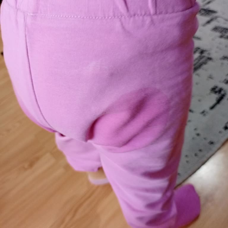 Molfix 5 Numara Bezde Yanlardan Sızdırma Problemi Ve Mağduriyet