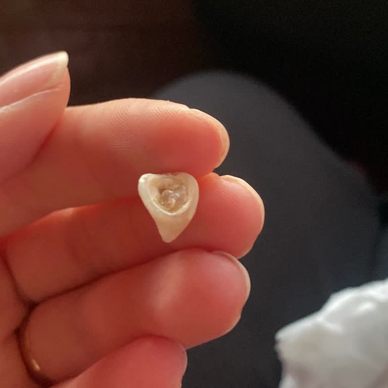 Kötü Yapıştırılan Kaplama Sonrası Yaşanan Mağduriyet Ve İlgisiz Klinik Yaklaşımı