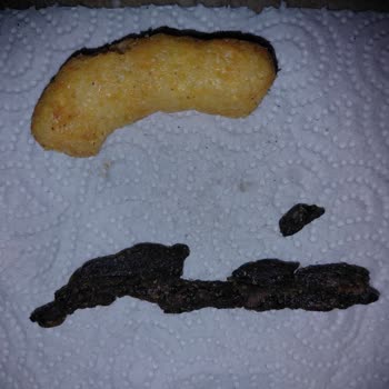 Aldığım Cipsin İçinden Çıkan Yabancı Madde Tedirginlik Yarattı