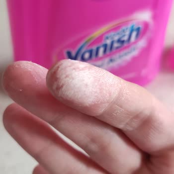 Vanish Kosla Oxi Action Sıvı Leke Çıkarıcı Ellerde Yanma Ve Acı Hissi Oluşturdu