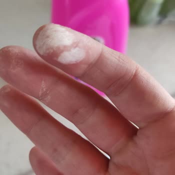 Vanish Kosla Oxi Action Sıvı Leke Çıkarıcı Ellerde Yanma Ve Acı Hissi Oluşturdu