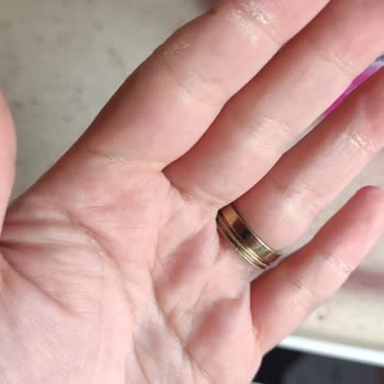 Vanish Kosla Oxi Action Sıvı Leke Çıkarıcı Ellerde Yanma Ve Acı Hissi Oluşturdu